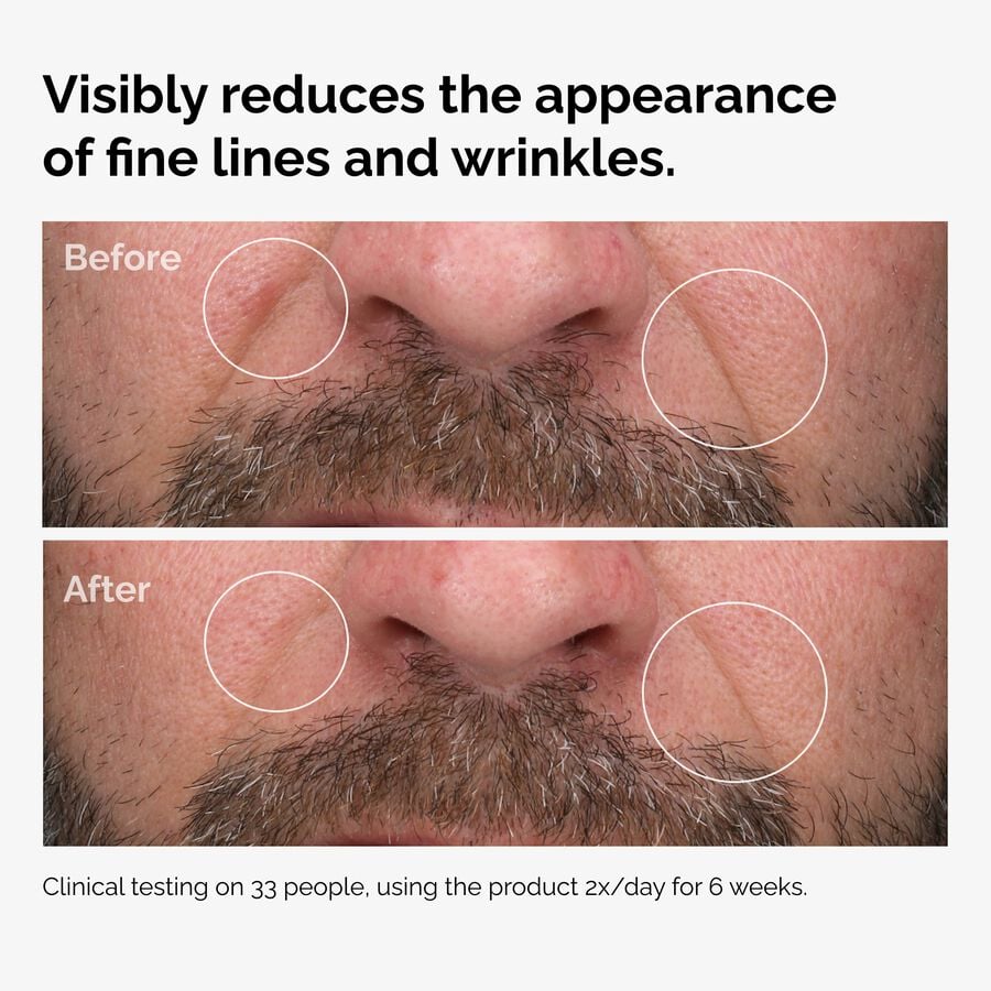 100-fermented-rose-hip-seed-oil-r6 100pct-fermented-rose-hip-before-after-wrinkles.jpg