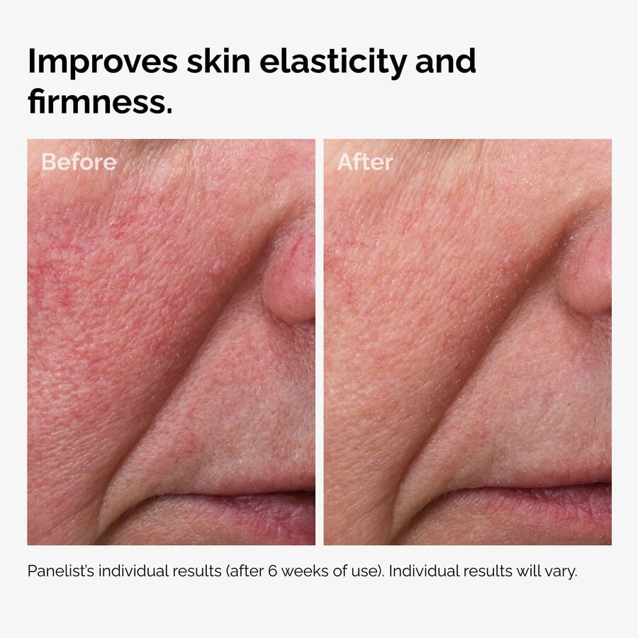 100-fermented-rose-hip-seed-oil-r6 100pct-fermented-rose-hip-before-after-elasticity.jpg