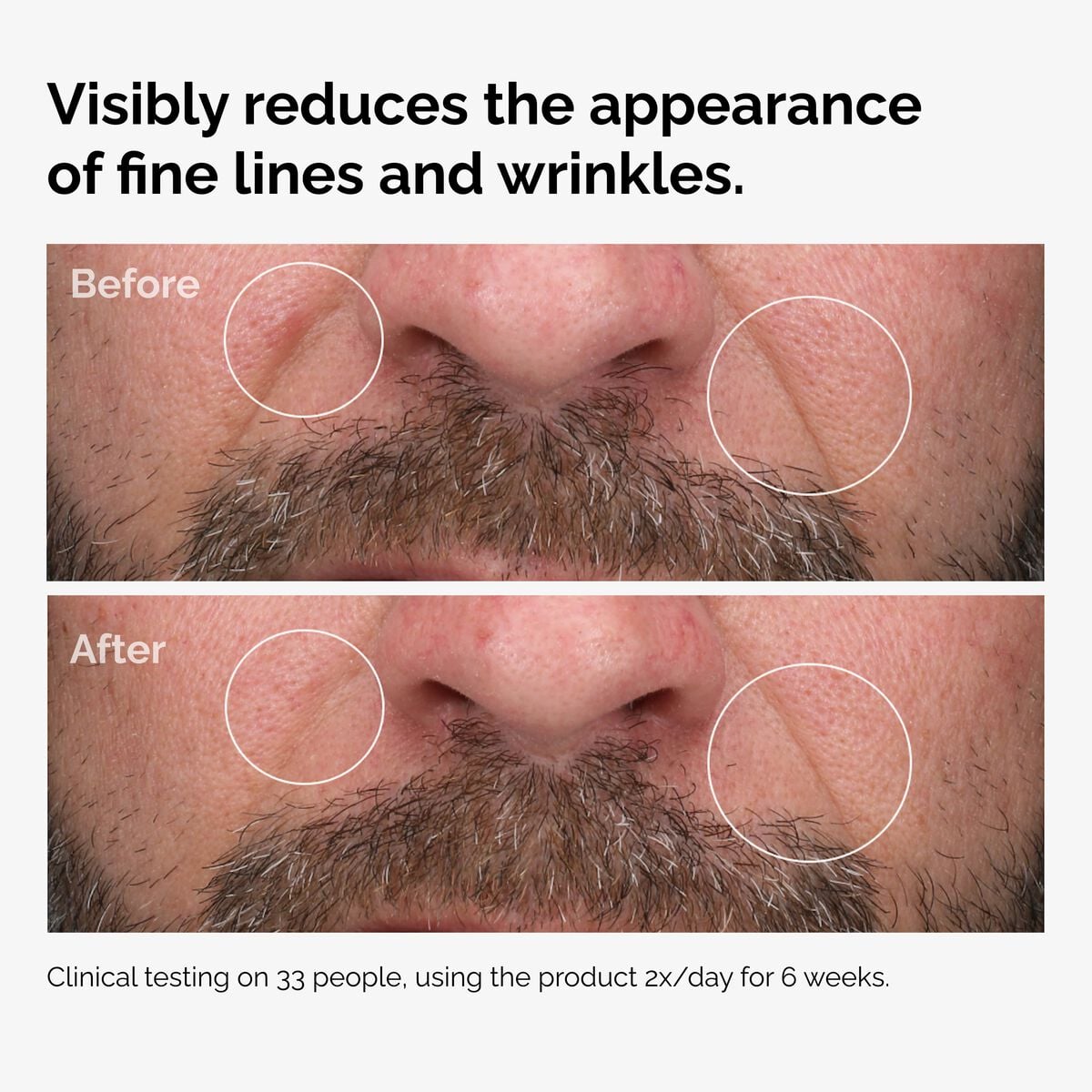 100-fermented-rose-hip-seed-oil-r6 100pct-fermented-rose-hip-before-after-wrinkles.jpg