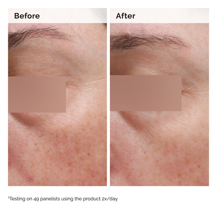 niacinamide-5-face-and-body-emulsion-e9 2024-08-23-ORD-Nia-5pct-Face-Body-B-A-Elasticity-Global-02-1x1.jpg