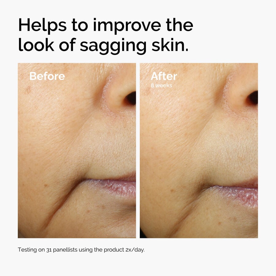 caffeine-3-escin-1-face-serum-q7 ord-caffeine-3pct-escin-1pct-face-serum-before-after-sagging.jpg