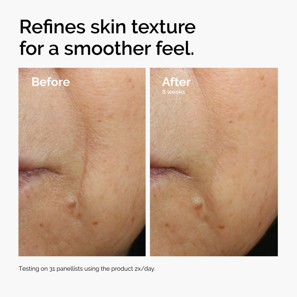 caffeine-3-escin-1-face-serum-q7 ord-caffeine-3pct-escin-1pct-face-serum-before-after-texture.jpg