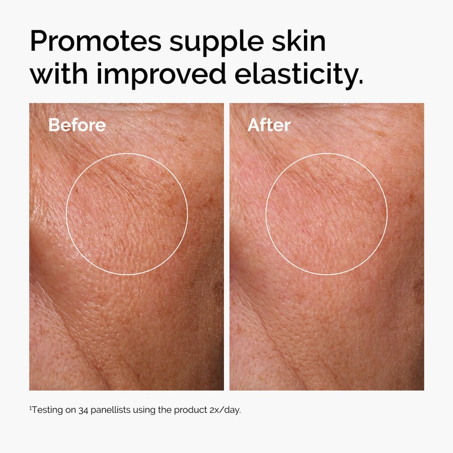 hyaluronic-acid-2-b5-with-ceramides-o4 ord-hyaluronic-acid-2pct-b5-hydrating-serum-before-after-elasticity.jpg