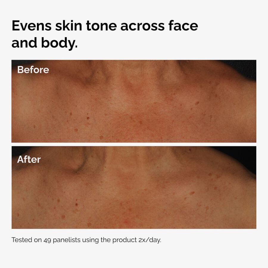 the-body-care-collection-x4 ord-niacinamide-face-body-serum-before-after-even-tone-graphic.jpg